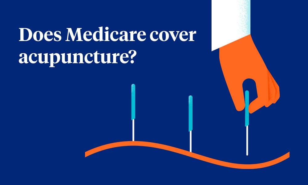 Does Medicare cover acupuncture? | UnitedHealthcare